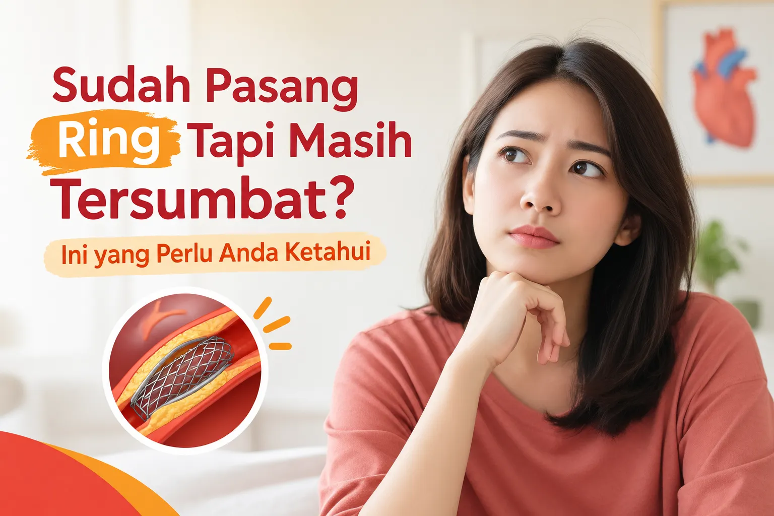 Sudah pasang ring jantung tetapi masih tersumbat, ilustrasi pembuluh darah dan wanita